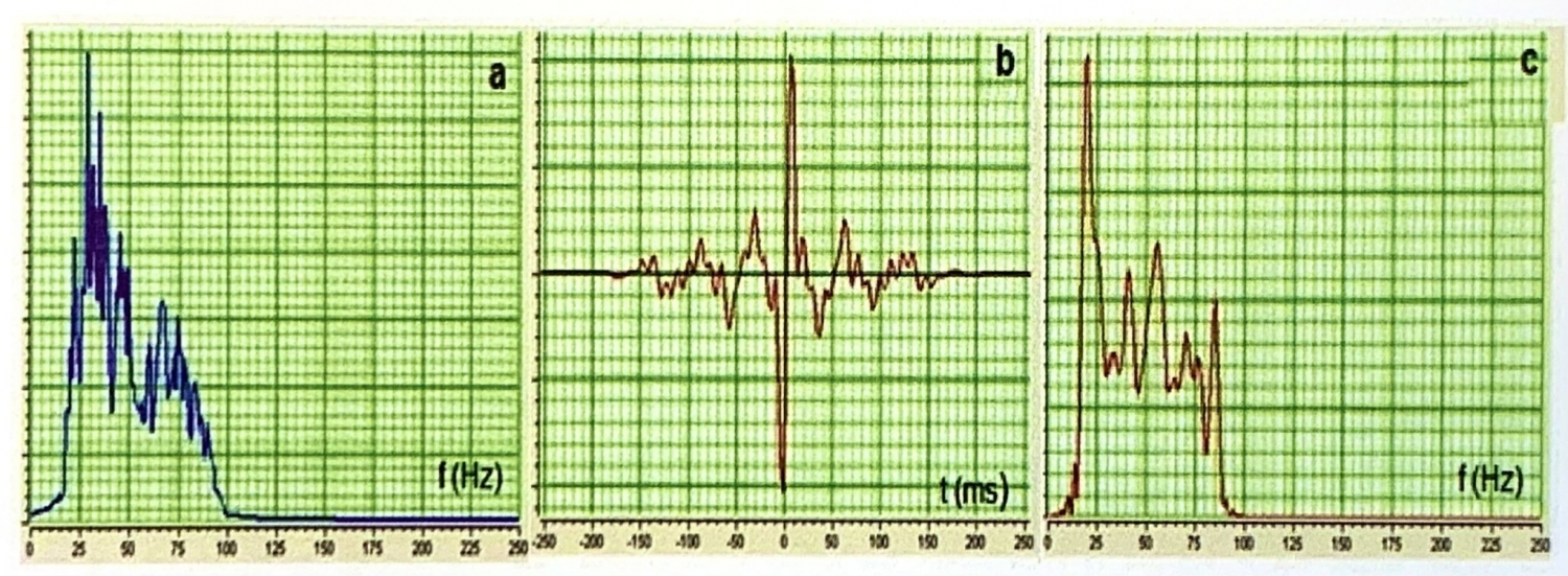 Biến đổi ngược sau cộng sóng - Phần 2