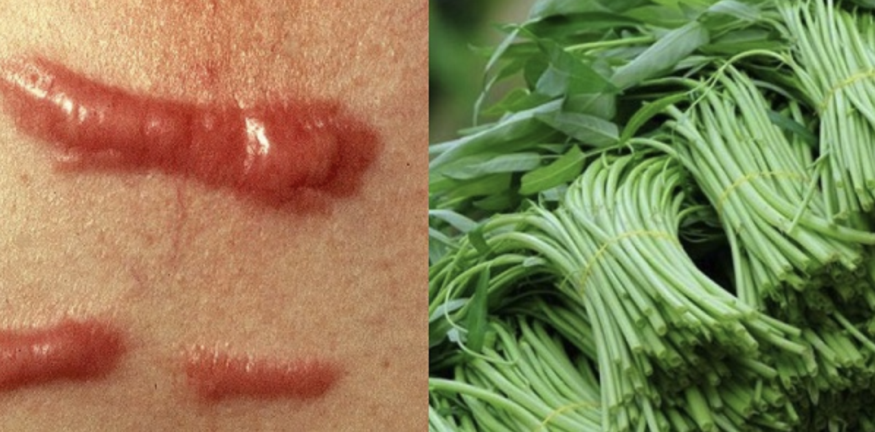 Những thói quen ăn rau muống không đúng, dễ rước bệnh vào thân